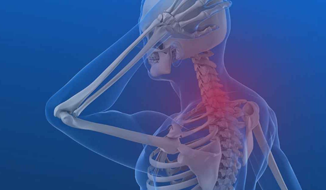 Exaggerated Curves of the Spine – Kyphosis