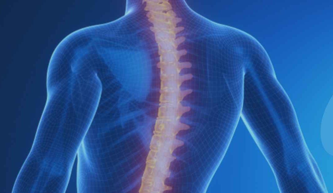 Exaggerated Curves of the Spine – Scoliosis
