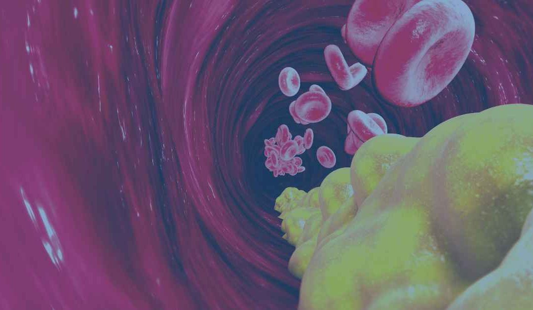 Blood Lipid Profiles